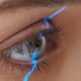 Comment faire pour ne pas cligner des yeux pendant la chirurgie au laser ?