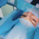 L’œil peut-il bouger pendant la réalisation du LASIK ?
